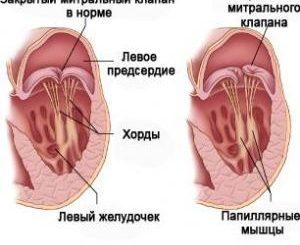 Додаткова хорда