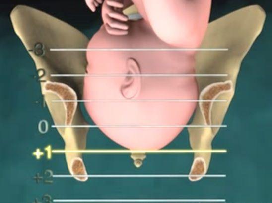 3D Medical Animation: the position of the fetal head