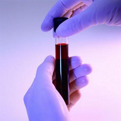 Interesting facts about blood