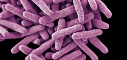 Mycobacterium tuberculosis