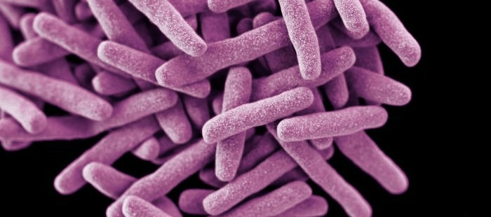 Mycobacterium tuberculosis