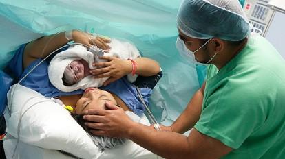 How to perform a Caesarean Section